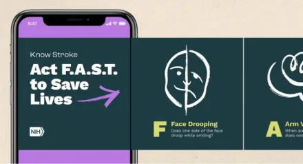A carousel that drives home the signs of stroke and tells people to act F.A.S.T. to save lives.